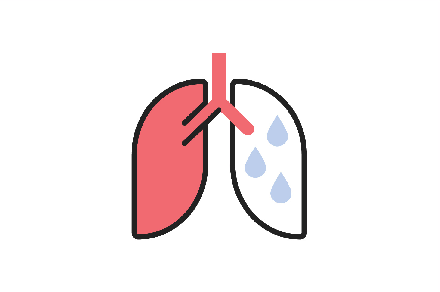 Dies ist eine Erklärung des Begriffs nasse Lunge