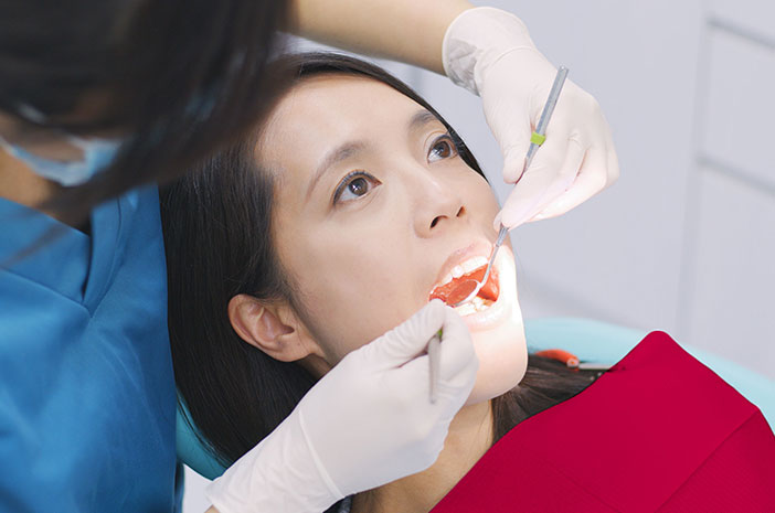 Удаление зубного камня, каковы процедуры и преимущества?