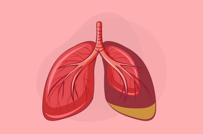 Voici comment diagnostiquer une infection des voies respiratoires