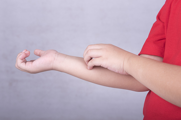 5 действий, которые помогут избавиться от укусов клопов у вашего малыша