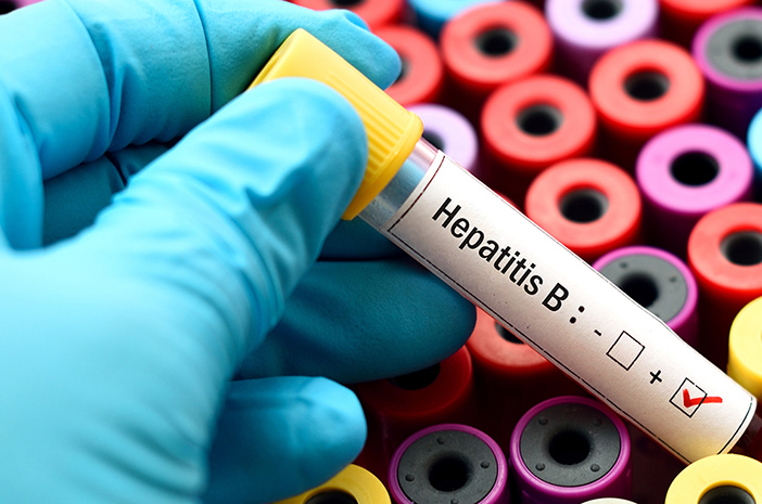 Transmitida a través de fluidos corporales, ¿la hepatitis B es más peligrosa?