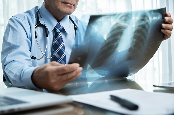 7 Estas enfermedades se pueden conocer por radiografías de tórax