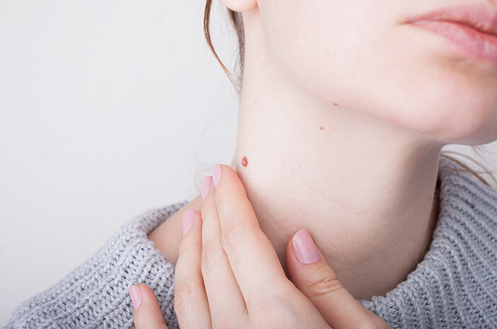 Uppstår vårtor på halsen på grund av hormoner eller sjukdom?