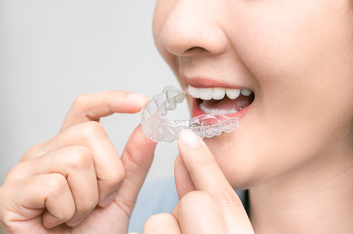 Mythes et faits sur les appareils dentaires à comprendre