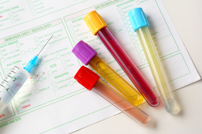 4 faits sur les tests sérologiques que vous devez savoir