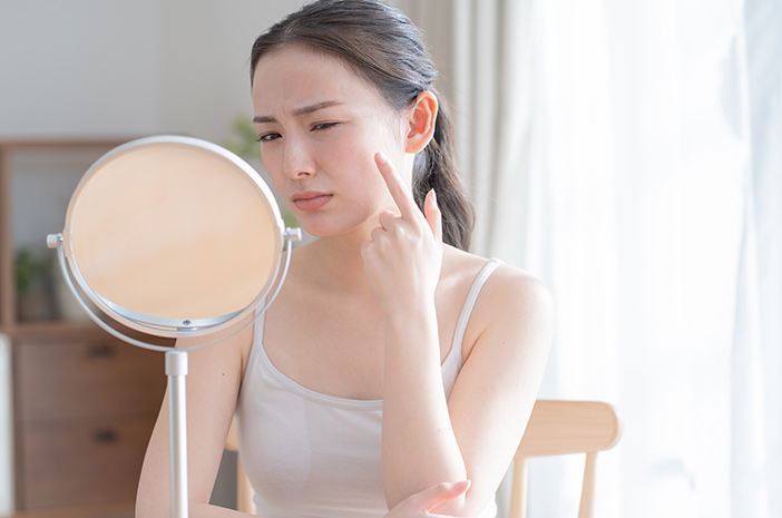 4 moduri de a scăpa de cicatricile de acnee în mod natural