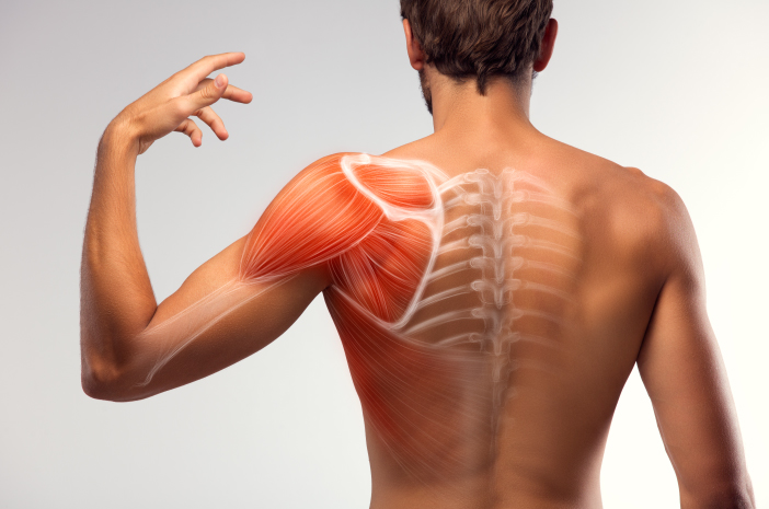 7 Dinge, die Schulterschmerzen verursachen können