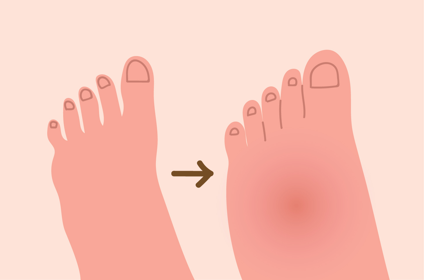 Navike koje mogu uzrokovati natečene noge tijekom trudnoće