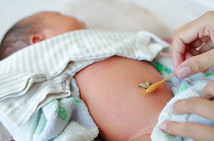 Hur man tar hand om barnets navelsträng för att hålla den borta från infektion