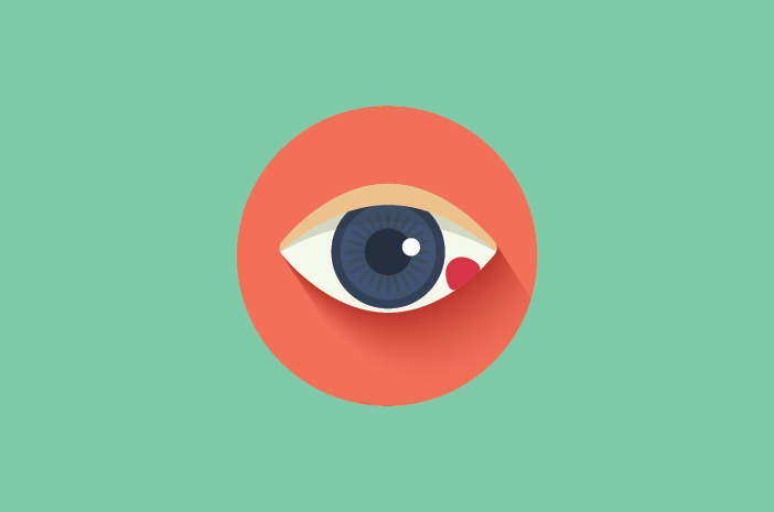 Gezwollen oogleden zijn een symptoom van endoftalmitis