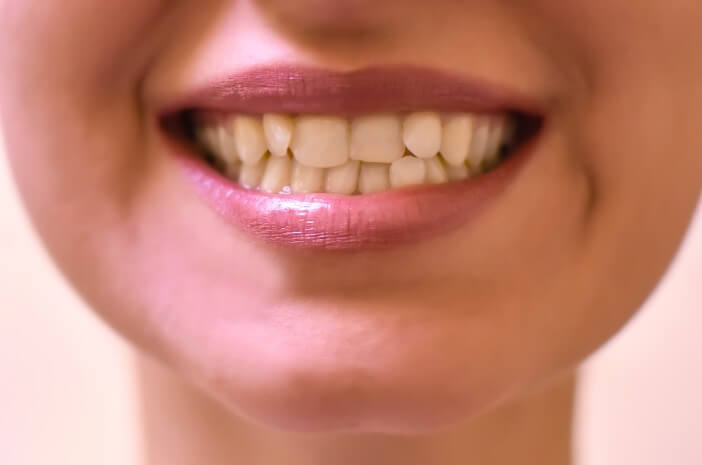 Disposition des dents en désordre, est-ce vraiment l'effet de facteurs génétiques?