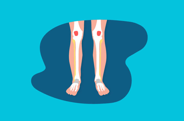 Dessa 5 funktioner hos de torra benen för kroppen