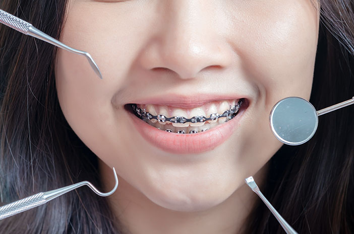 Uwaga, nieostrożne aparaty ortodontyczne są zagrożone rakiem jamy ustnej