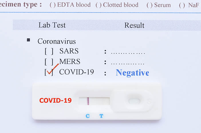 בדיקת COVID-19 לפני העלייה למטוס, לבחור ספוגית אנטיגן או PCR?