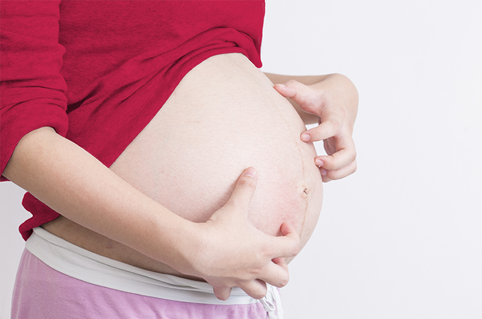 בטן מגרדת עקב הריון, נסה להשתמש בשמן זית