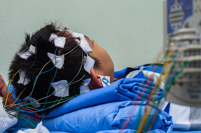 Ken de uitleg over elektro-encefalografie (EEG)