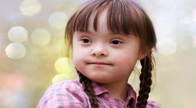 Trisomie 21, een van de oorzaken van het syndroom van Down bij kinderen