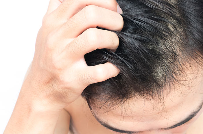 4 przyczyny infekcji skóry głowy
