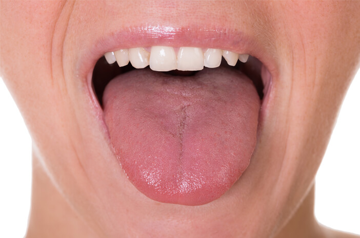 Taches blanches dans la bouche, méfiez-vous des signes de leucoplasie