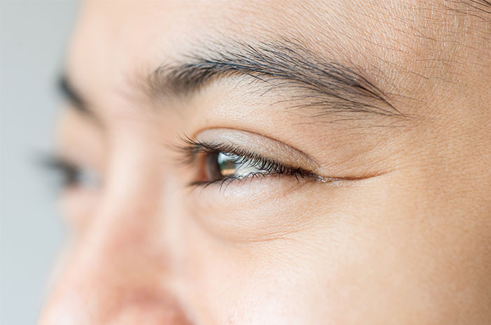 5 דרכים להיפטר מקמטים מתחת לעיניים ללא סמים